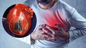 হাৰ্ট_এটেক_আহাৰ_আগতে প্ৰকাশ পোৱা ৮ টা মুখ্য লক্ষণ